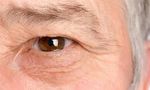 روش های درمان ورم اطراف چشم


ورم چشم (Periorbital puffiness) به معنای تورم ناحیه ی اطراف چشم است. منطقه ی اطراف چشم که به نام کره ی چشم یا حدقه ی ...