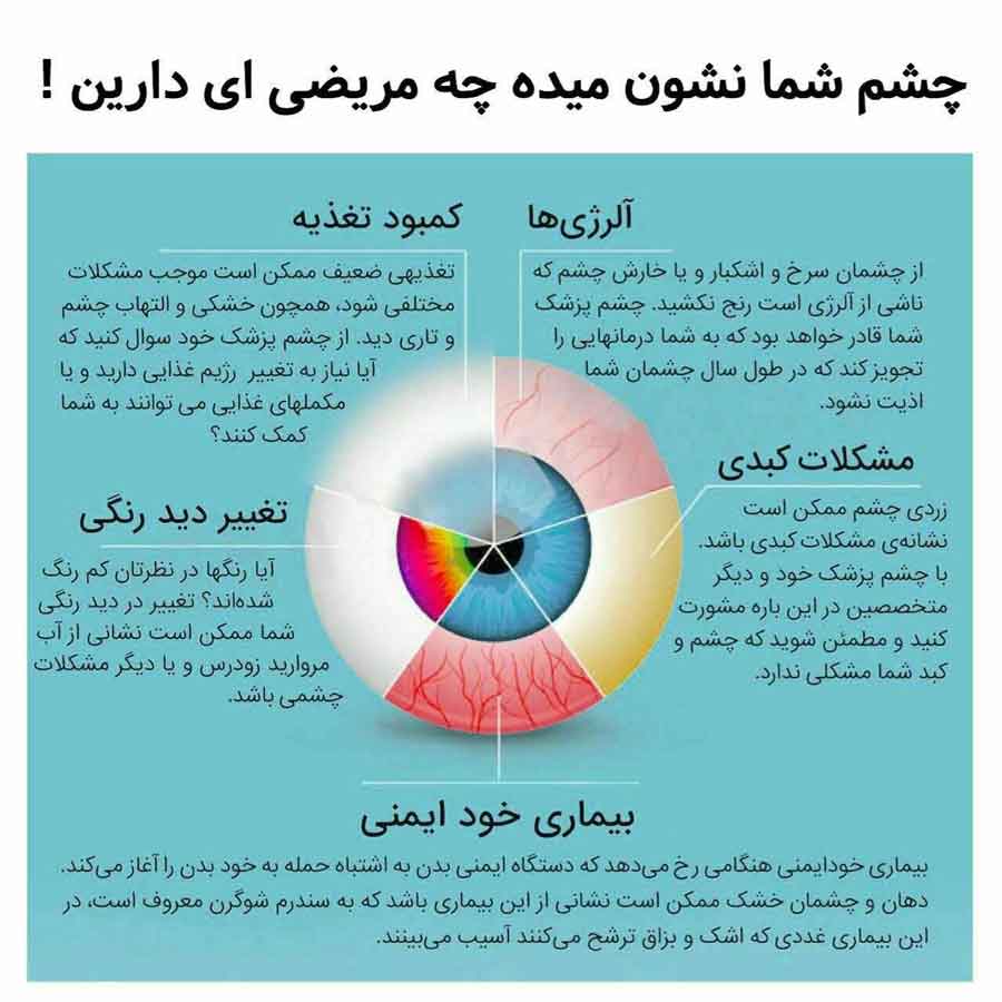 چشم شما نشون میده چه بیماری دارید 