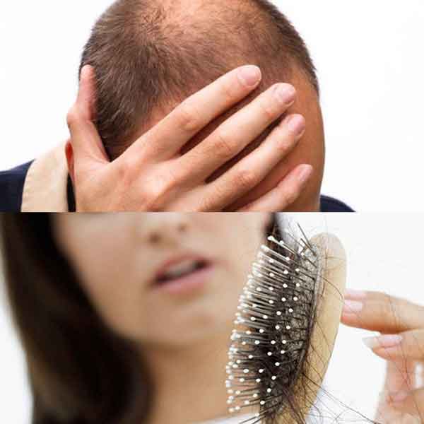 عوامل موثر در ریزش_مو و نازکی_مو و سفیدی زود رس  