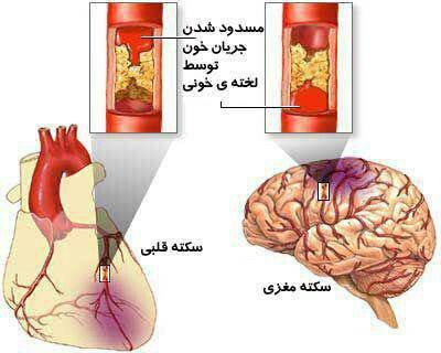 در زمستان مغزتان کمتر پیام تشنگی صادر میکند، اما 