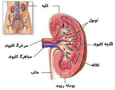 اگر کلیه شن سازی دارید،  هفته ای 2 روز ناشتا دمکر