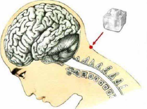 مدت 20 دقیقه یخ رو روی قسمت مشخص شده بذارید، تا ب