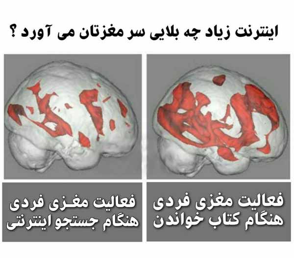 اینترنت زیاد چه بلایی سر مغزتان می‌آورد  تحقیقات 