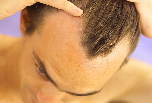 مو و پوست سر چه چیزی در مورد سلامتیان به شما می گویند