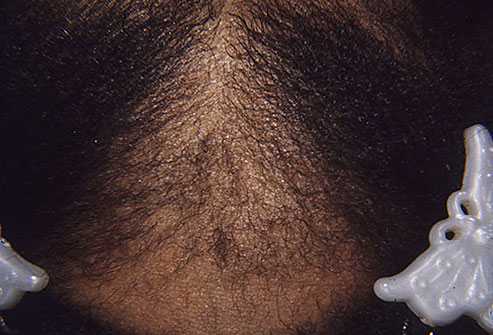 مو و پوست سر چه چیزی در مورد سلامتیان به شما می گویند