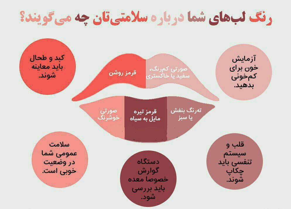 آنچه رنگ لبهای شما درباره سلامتی شما میگویند