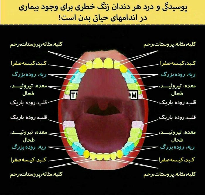 پوسیدگی و درد هر دندان زنگ خطری است برای وجود بیم