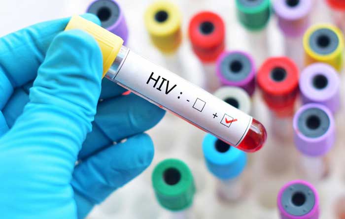 دانستنی‌هایی درباره اچ‌آی‌وی
