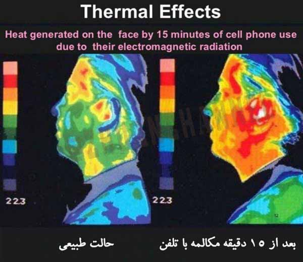 حرارت توليد شده بر روي صورت پس از 15 دقيقه استفاد