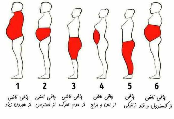 چاقی شما کدام نوع است و راه درمان هر یک چیست  ۱- 