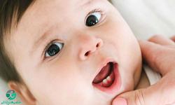 دندان درآوردن نوزاد | زمان و علائم دندان درآوردن 