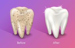 راه حل سفید کردن دندانها را یاد بگیریم