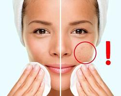 با رعایت این چند نکته سلامتی پوست صورتتان را تضمب