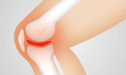 علت دردهای متعدد افراد مبتلا به آرتروز زانو چیست؟