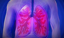 ثبت تصویر سلول‌های ایمنی ریه‌ها هنگام مقابله با ع