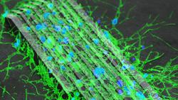 میکروربات‌هایی که اتصال میان سلول‌های عصبی را برق