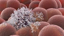 قرنطینه سلول‌های سرطانی برای جلوگیری از تغذیه و ر