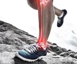 شایع ترین آسیب های ورزش دویدن