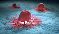 نیروهای ایمنی مهمی که به جنگ سرطان تخمدان می‌روند