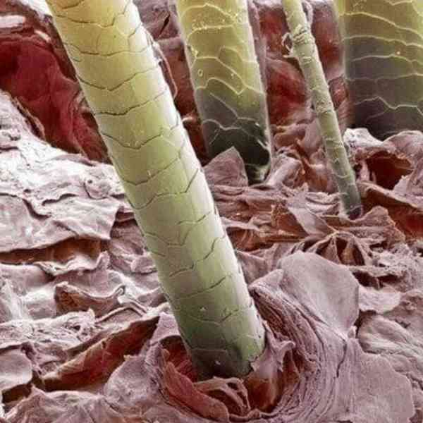 موی انسان زیر میکروسکوپ     