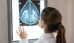 درمان بهتر سرطان پستان آمد  این یافته که تومورهای