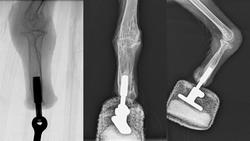 کرکسی که نخستین پای مصنوعی دائمی را دریافت کرد