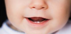 چه‌طور از اولین دندان‌های کودک مراقبت کنیم؟